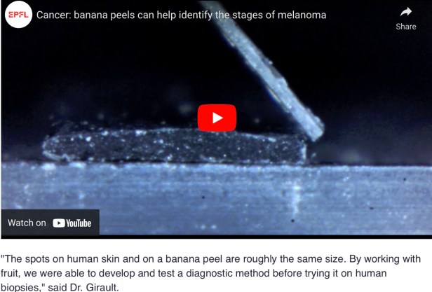 Banana Peels Can Help Identify The Stages Of Melanoma A New Theory Of